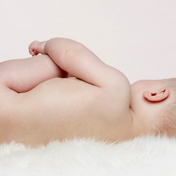 Assaduras em bebê:  saiba por que aparecem e veja como prevenir e tratar